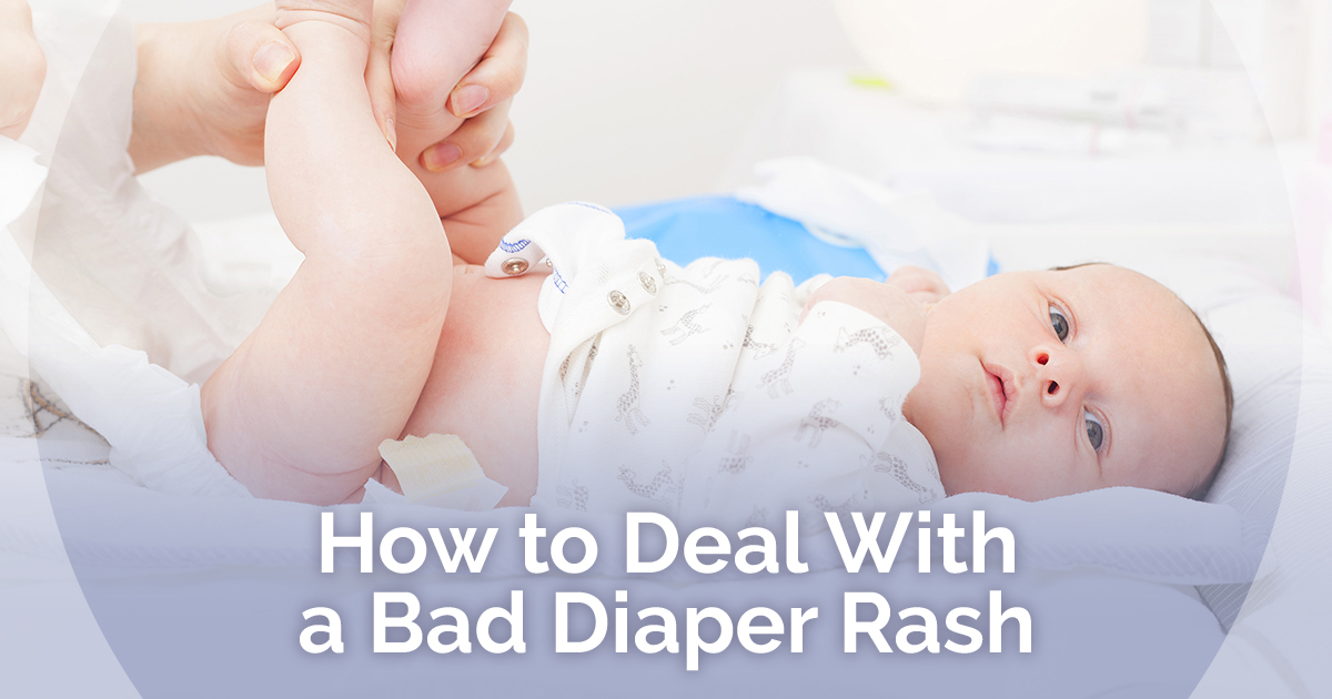How to Deal With a Bad Diaper Rash 